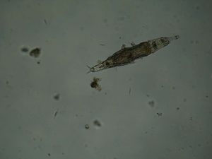 Rotifera Micrograph (brightfield).JPG